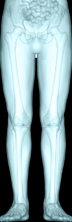 Spenomegaly leg